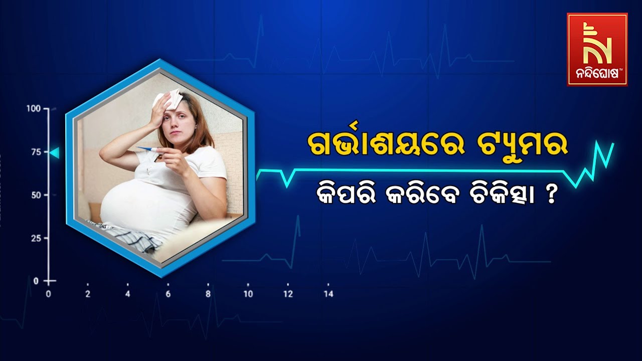 🔴 Live | ଗର୍ଭାଶୟରେ ଟ୍ଯୁମର : କିପରି କରିବେ ଚିକିତ୍ସା ?