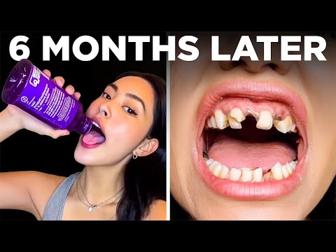 Dumbest Viral TikTok Trends