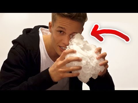 Ich habe mich verletzt... 😱 (Vlog)