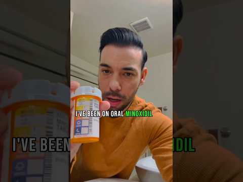 My Oral Minoxidil Journey - 12 Months #hairlosstreatment