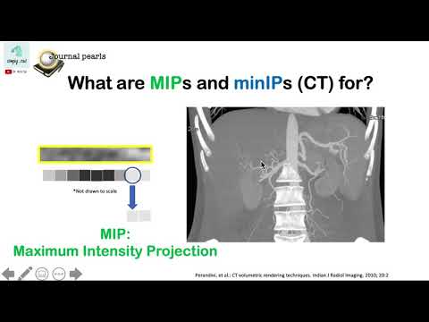 Maximum & minimum Intensity Projection (MIP, minIP) in CT