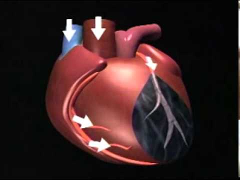 Heart Health and Cardiac Care Video  Heal Your Heart