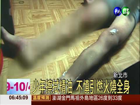 打翻精油燒身 14歲少年全身燙傷