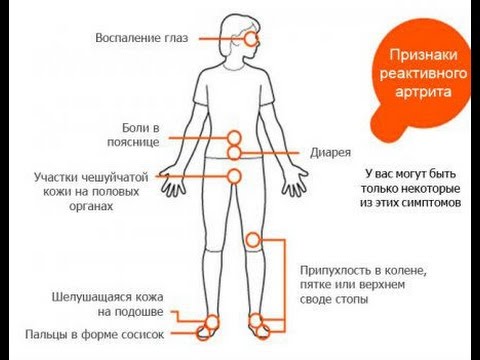 Дистальные суставы пальцев рук это Утром падаю от боли в спине