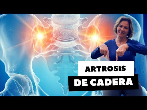 ARTROSIS DE CADERA PARTE 1
