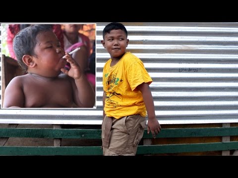 Former Chain-Smoking Toddler, Now 9, Healthy After Kicking Habit