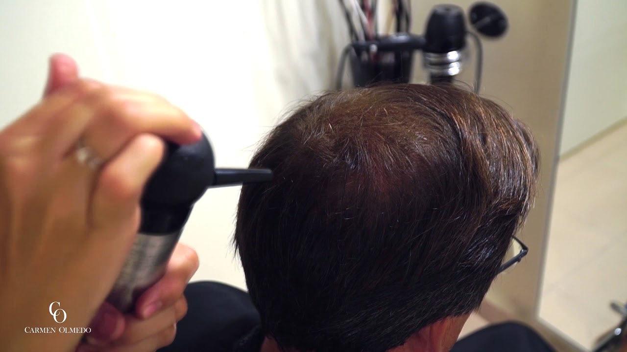 Cómo disimular alopecia con fibras capilares