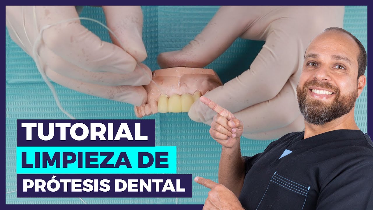 Watch Cómo LIMPIAR una Prótesis DENTAL Fija ❄ ( Video TUTORIAL) ⚡⚡ Now Cómo LIMPIAR una Prótesis DENTAL Fija ❄ ( Video TUTORIAL) ⚡⚡