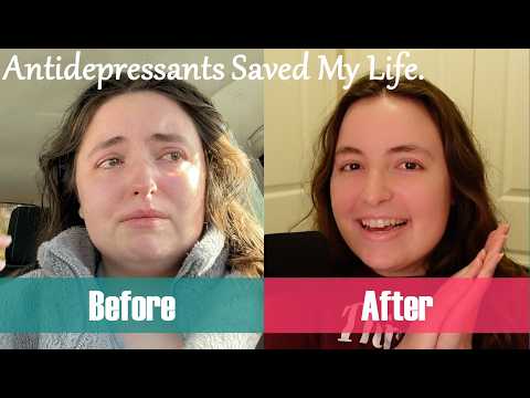 Wellbutrin Gave Me My Life Back | My Antidepressant Experience