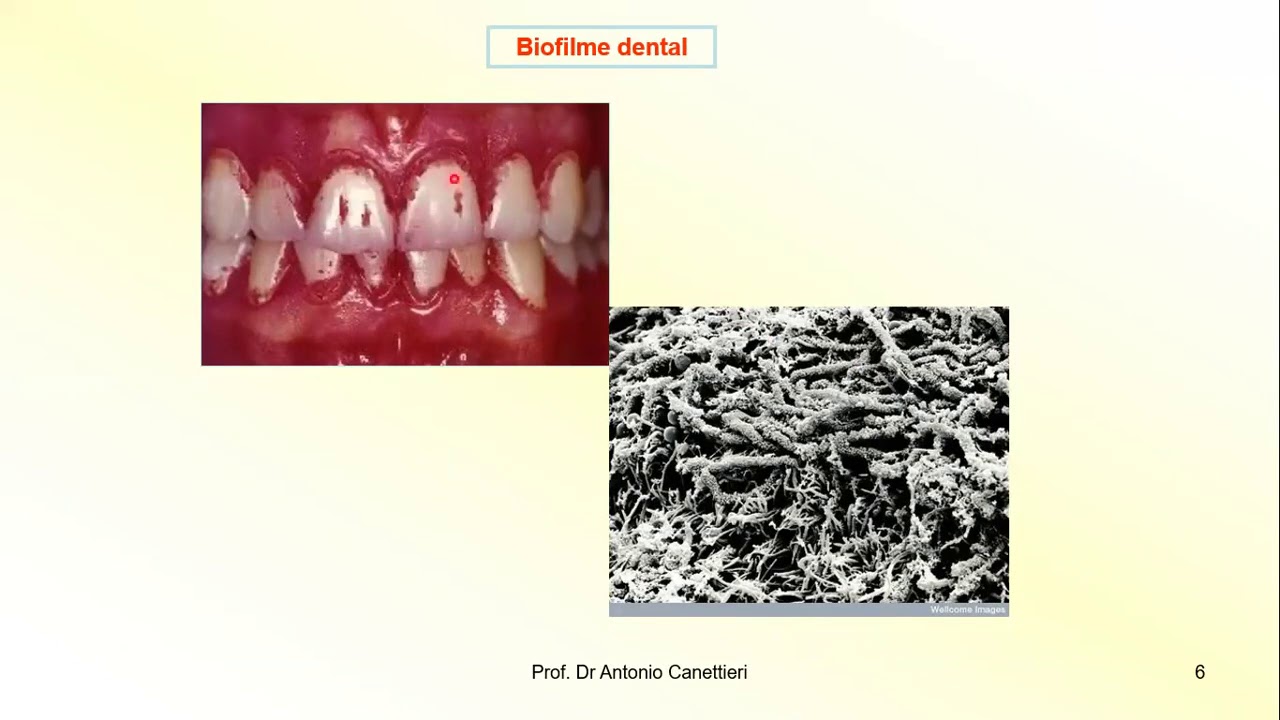 MICROBIOLOGIA BUCAL- Biofilme dental