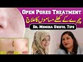 Open Pores Treatment | Useful Skincare Tips with Dr Momina | Rabi Pirzada