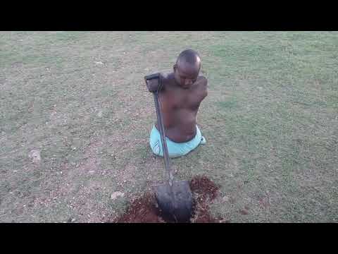 Bullies Call Him Monkey Because He Has No Legs and No Arms Amputee| BORN DIFFERENT LIVING