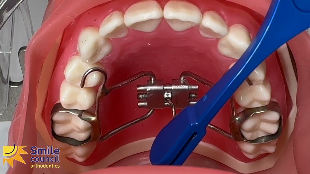 Expander
