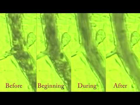 Bemer effect on the microcirculation during an 8 minute session