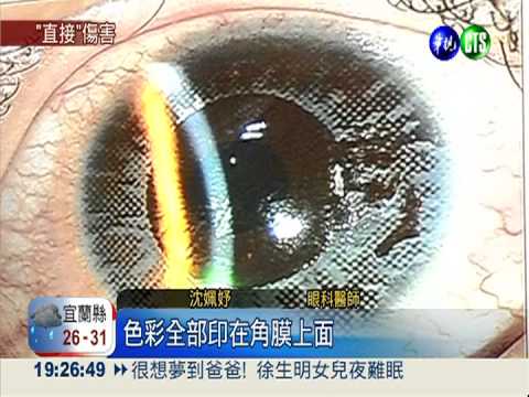 變色片"落漆" 色素傷眼恐害失明