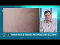 Control Medical 20 Video thumbnail