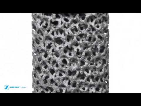 Dental Implant-Khoury-Trabecular Metal Material