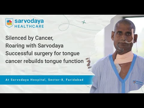 54-Year-Old Man Beats Tongue Cancer with Advanced Surgery! 