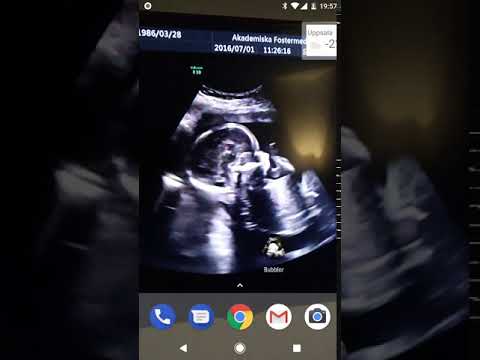 Bubblor video thumbnail