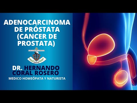 Prostata popolare A causa di ciò che accade prostatite