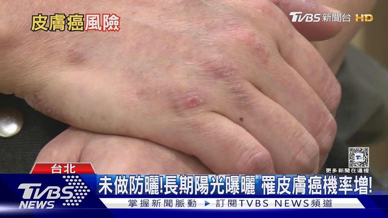 不養成「這習慣」罹癌風險較高 醫警告:出現「這症狀」速就醫!