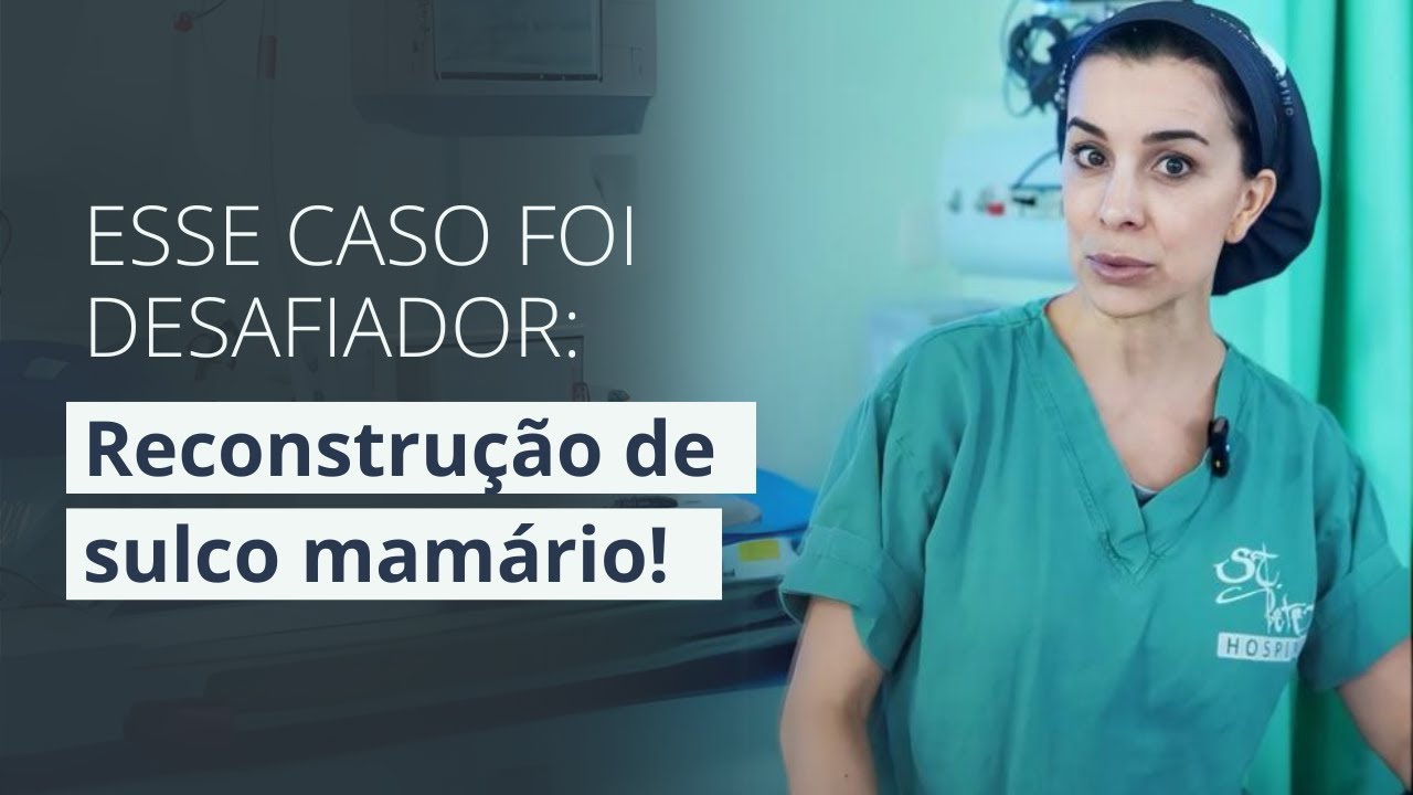 Reconstrução de Sulco Mamário: Solução para Cirurgias Mal Sucedidas