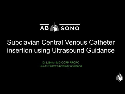 Ultrasound-guided subclavian venous access