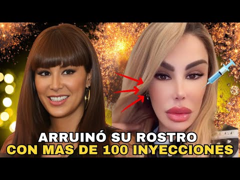 From star to unrecognizable: Ninel Conde's extreme transformation