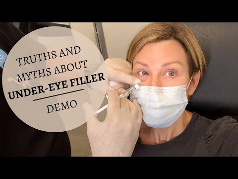 Under Eye Filler Truths & Myths + Demo | Dominique Sachse