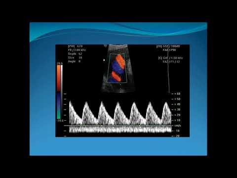 Obstetric Doppler Part 1