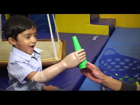 Prosthetic Myoelectric Arm Changes Child's Life
