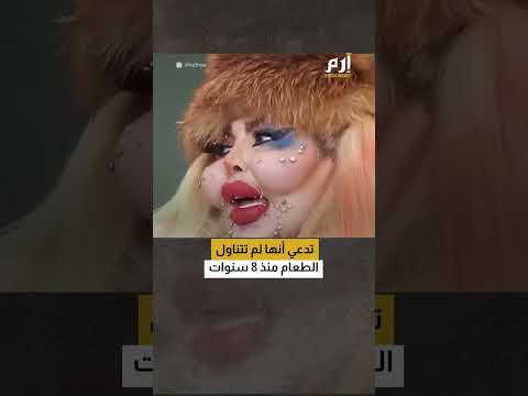 قصة بلوغر لا تُصدق.. 388 عملية تجميل و8 سنوات بلا طعام 