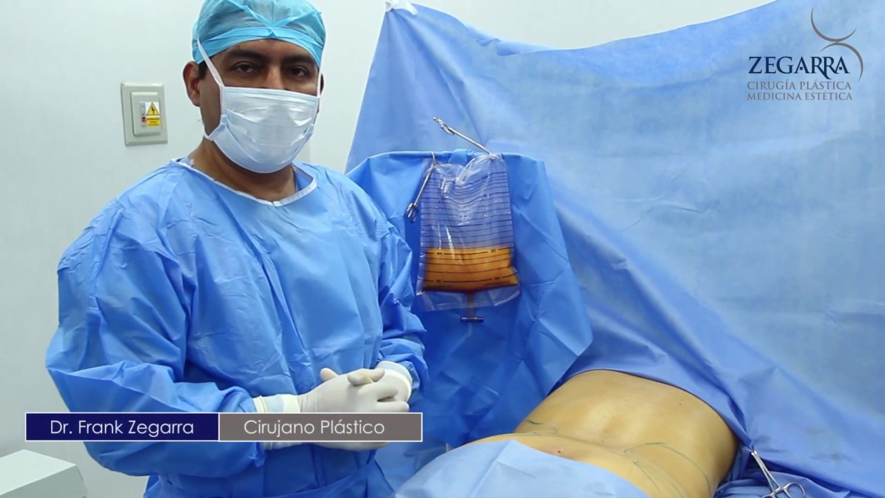 Lipotransferencia en Glúteos