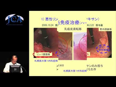 栄養学科 講演3「期待されるがん免疫治療の現在と将来」佐藤昇志（札幌医科大学医学部病理学第一講座）