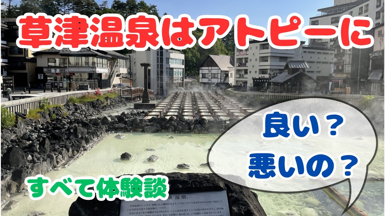 【体験談】草津温泉でアトピーが悪化することもある話