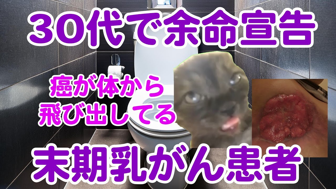 【閲覧注意】乳癌を放置し続けた20代女性の末路