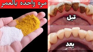 سقوط الجير وتبييض الأسنان في 3 دقائق فقط ❗️بوصفة طبيعية فعّالة بدون طبيب❗️#طبيعي_وبس