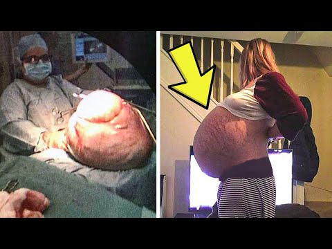 Woman's Stomach Just Keeps Getting Bigger Then She Realizes Shes Not Pregnant!