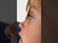 Arianka Má Na Oku Klíště 🥹 Ach Joooo