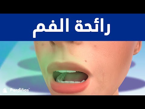 رائحة الفم ©