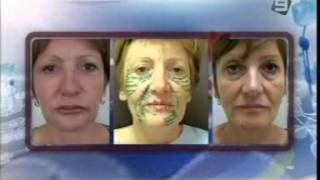 Доктор Авишай Вайнбергер - О Работе Пластического Ххирурга ד"ר וינברגר: על עבודתו של המנתח הפלסטי