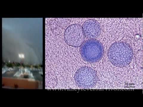 Valley Fever Danger in Desert Dust Storms.  Learn the truth (storm / haboob footage)