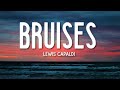 Bruises - Lewis Capaldi (Lyrics) 🎵