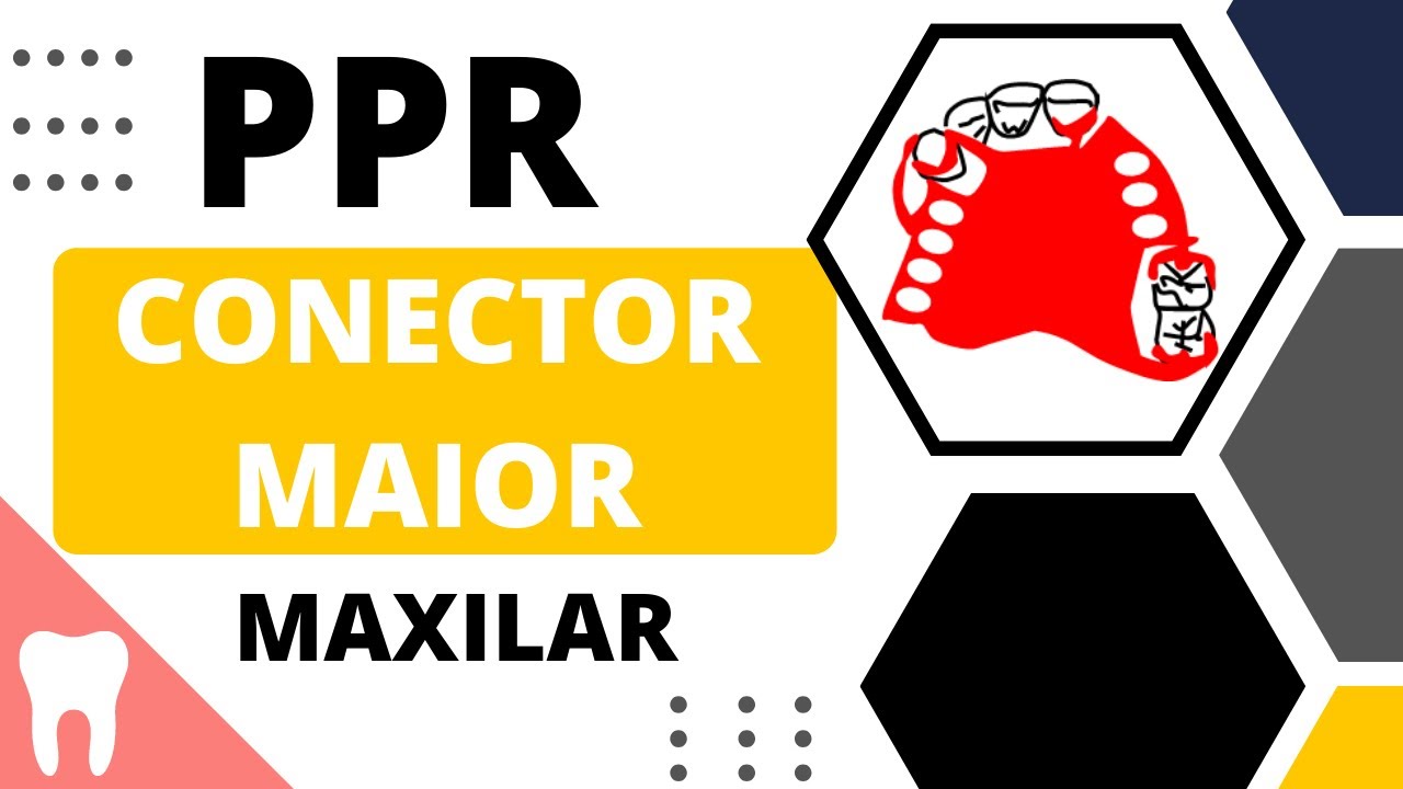 Entenda os CONECTORES MAIORES DA MAXILA