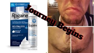 Minoxidil Beard | The Journey Begins |
The Experiment |  #facialfuzzfridays