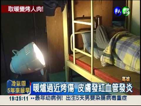 電暖器"烤人肉" 出現紅斑.血管炎