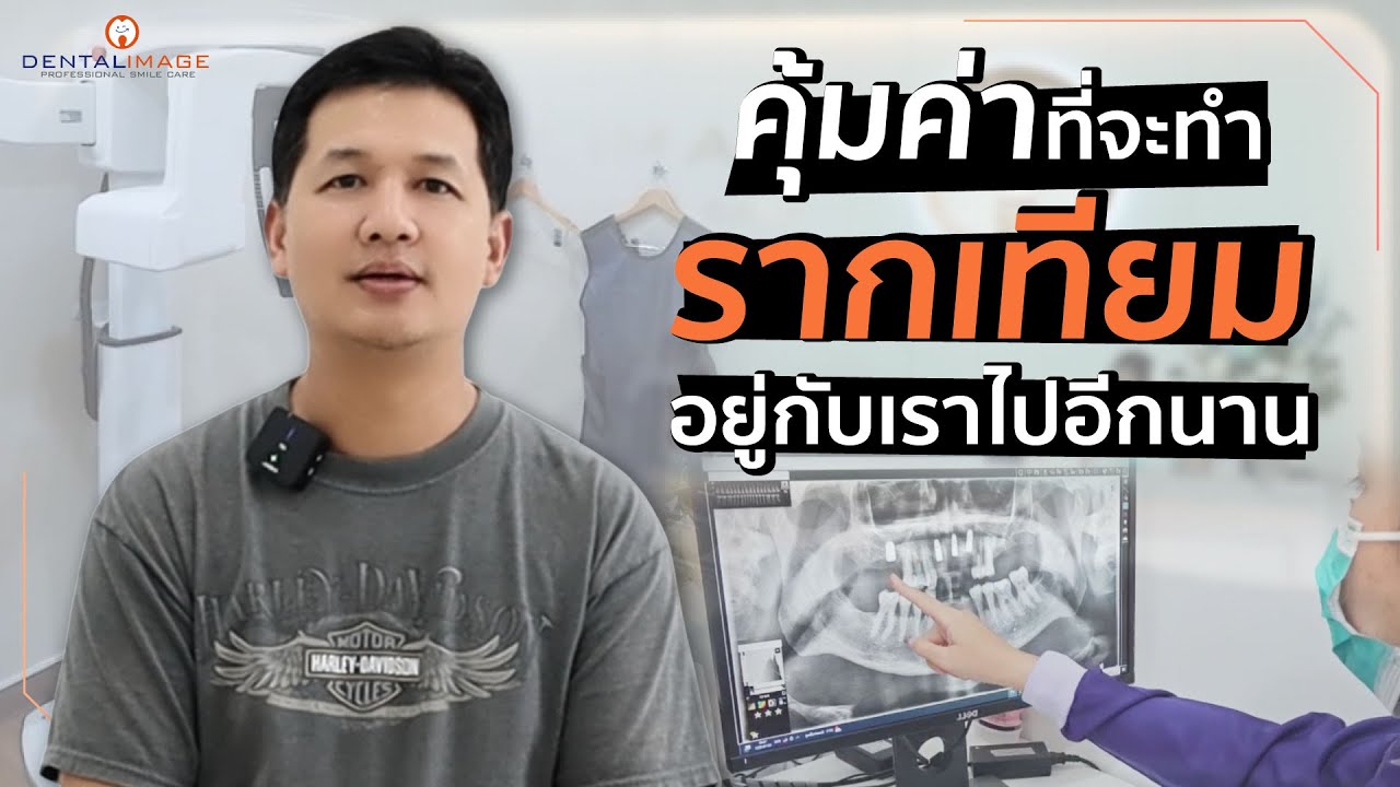 รีวิวรากฟันเทียมจากคนไข้ไทย 2