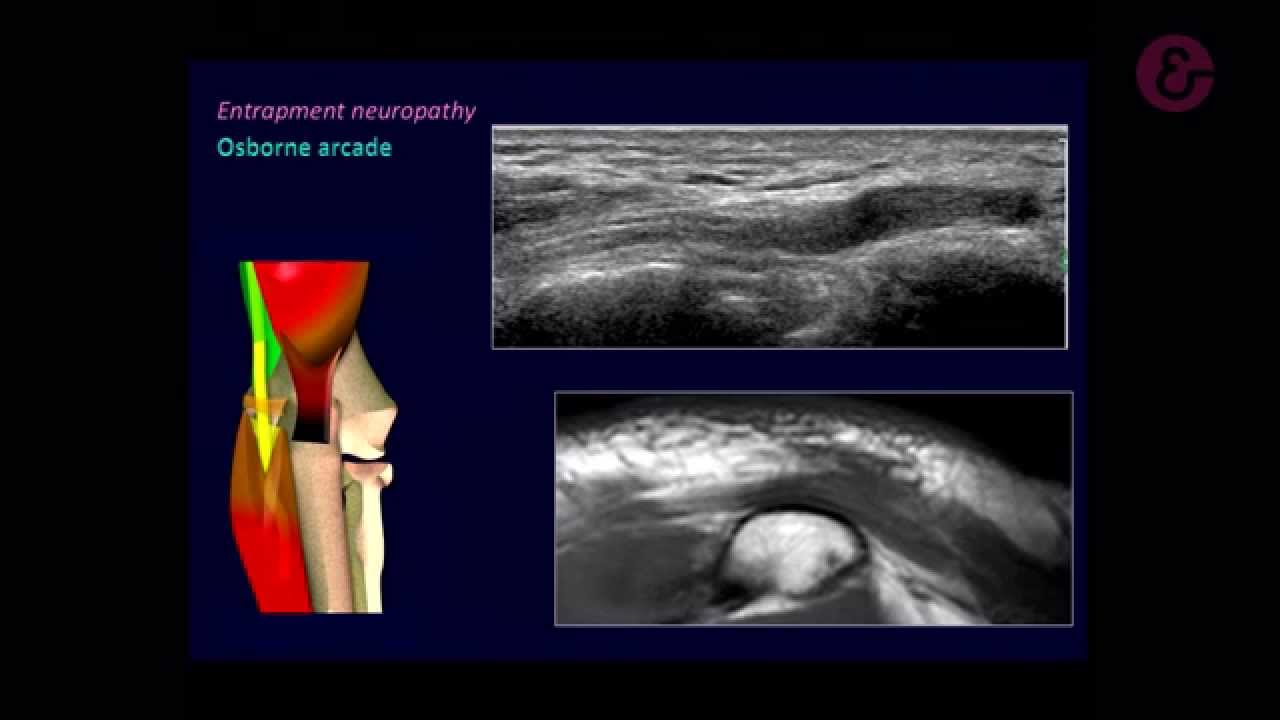 Watch Now Live demo by Stefano Bianchi MD. at ICMSU 2015 Live demo by Stefano Bianchi MD. at ICMSU 2015