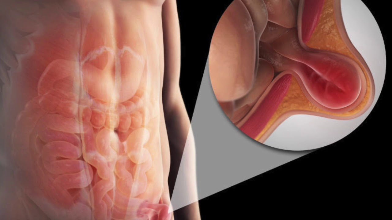 Jorge Armando Ramírez Ortega-19