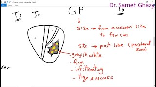 systemic pathology 59 : male genital system 3 ( cancer prostate ) سرطان البروستاتا